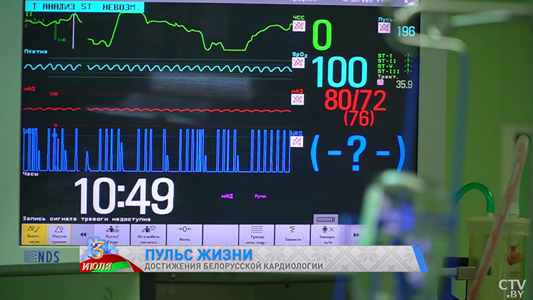 Как кардиологи спасают белорусские сердца? Побывали в РНПЦ и узнали о новейших методах лечения-25