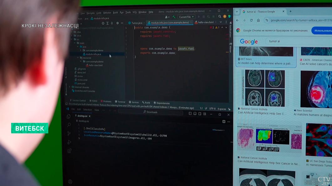 Студенты из Витебска разработали приложение для диагностики опухолей мозга – программа уже внедрена в больницах-8