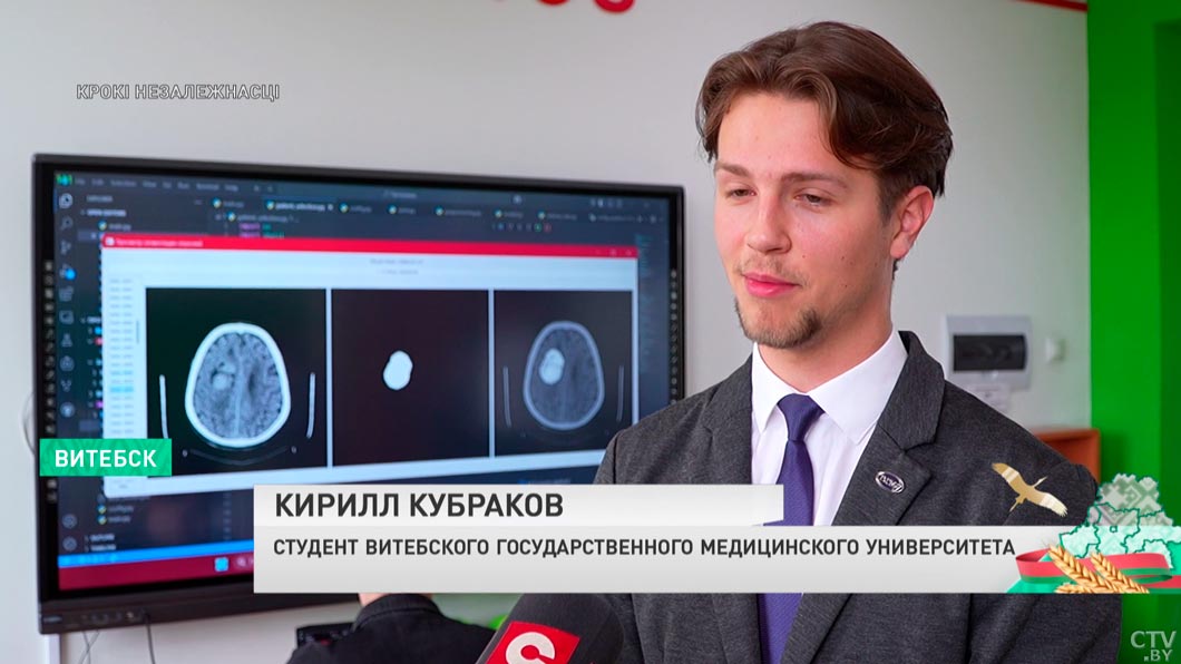 Студенты из Витебска разработали приложение для диагностики опухолей мозга – программа уже внедрена в больницах-6