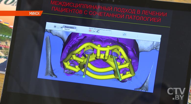 «Мне очень нравится моя профессия». Международный день стоматолога отмечается 9 февраля-19