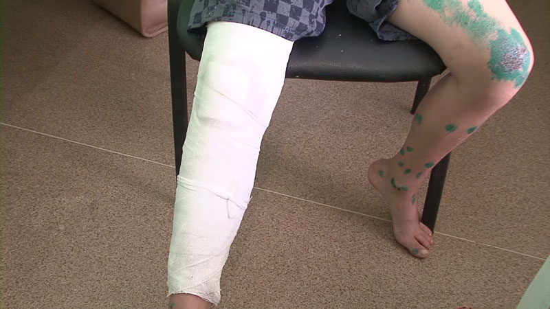 Пьяный поляк на фуре протаранил легковой автомобиль в Смолевичском районе: 2 человека погибли Пьяный поляк на фуре протаранил легковой автомобиль в Смолевичском районе: 2 человека погибли