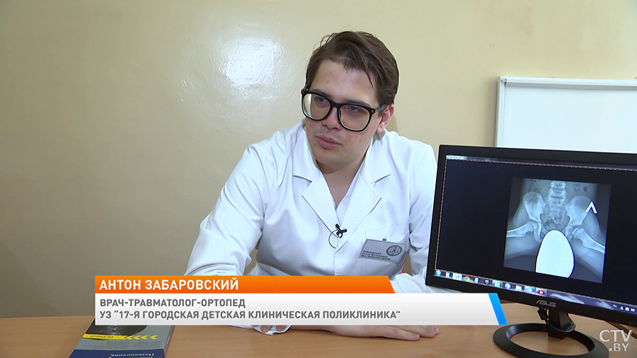 Что такое гипермобильность суставов и когда это небезопасно? Поговорили с детским ортопедом-1