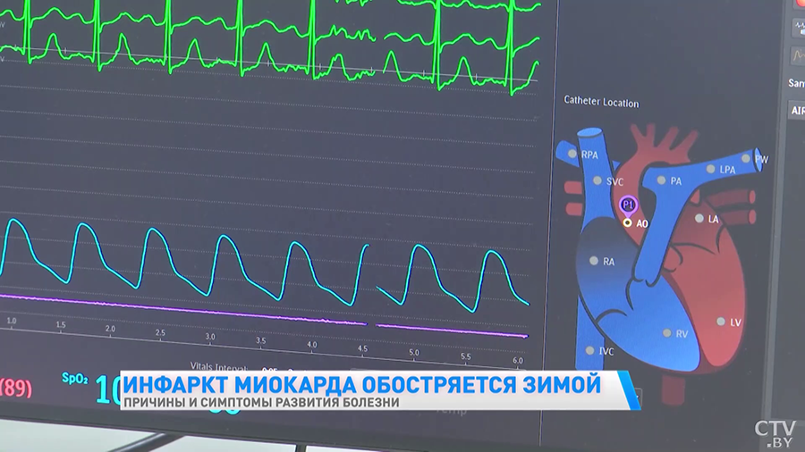 Курение и сидячая работа. Что ещё может стать причиной инфаркта миокарда?-7