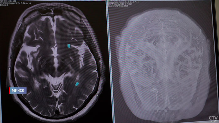 Помогает в реабилитации новорождённых и МРТ. Как используют ИИ в белорусской медицине?-40