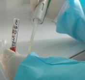 В Беларуси выздоровели 100 749 пациентов, у которых ранее был подтверждён коронавирус