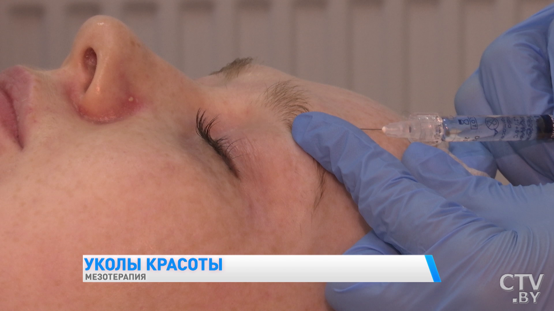 «Эти процедуры безболезненны и комфортны». Чем полезна мезотерапия и как она проводится? -4 «Эти процедуры безболезненны и комфортны». Чем полезна мезотерапия и как она проводится? -4