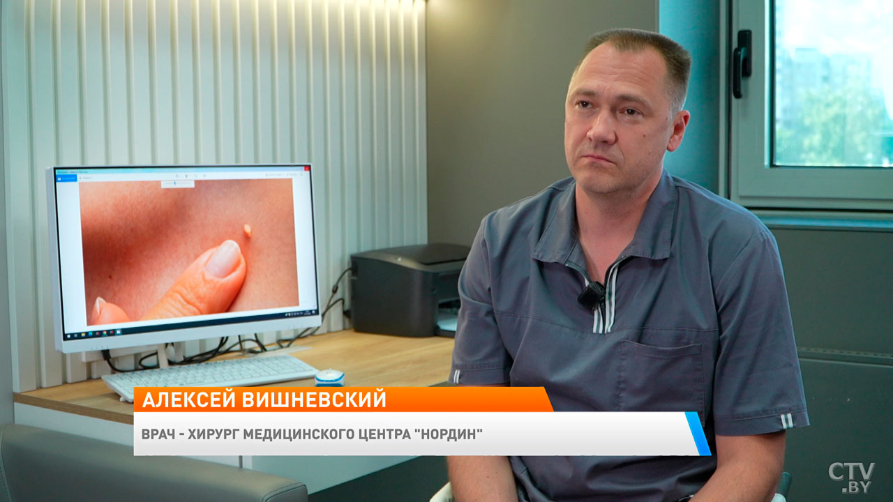 От бородавок до онкогенных форм – как лечат ВПЧ, рассказал врач медцентра «Нордин»-2