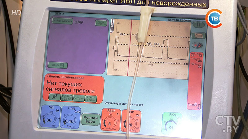 «От 500 граммов и выше». В Беларуси выхаживают недоношенных детей с экстремально низкой массой тела. Рассказывают врачи-10