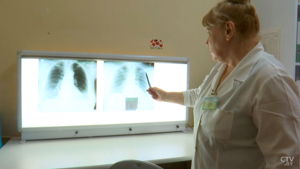 В Беларуси уровень заболеваемости туберкулезом снизился на 19%-6