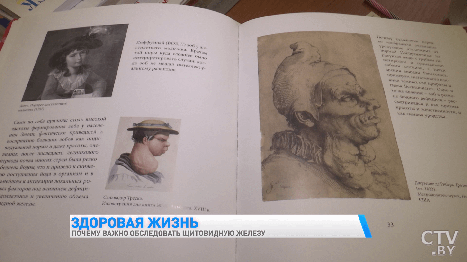 Появляется усталость и ухудшается память. Какие ещё признаки говорят о нарушении в работе щитовидной железы-7