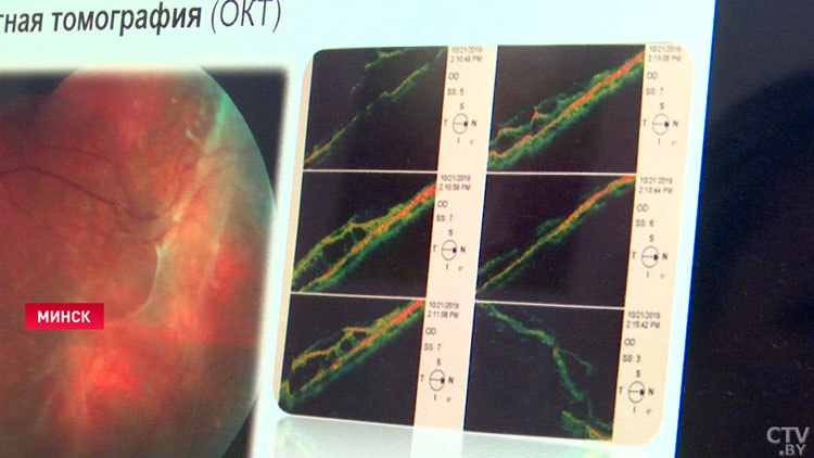 Прорыв в белорусской офтальмологии – чем может похвастаться отечественная медицина?-7