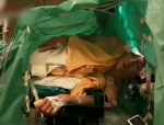 Видео: Оперный певец из Словении исполнил Шуберта во время операции на головном мозге 
