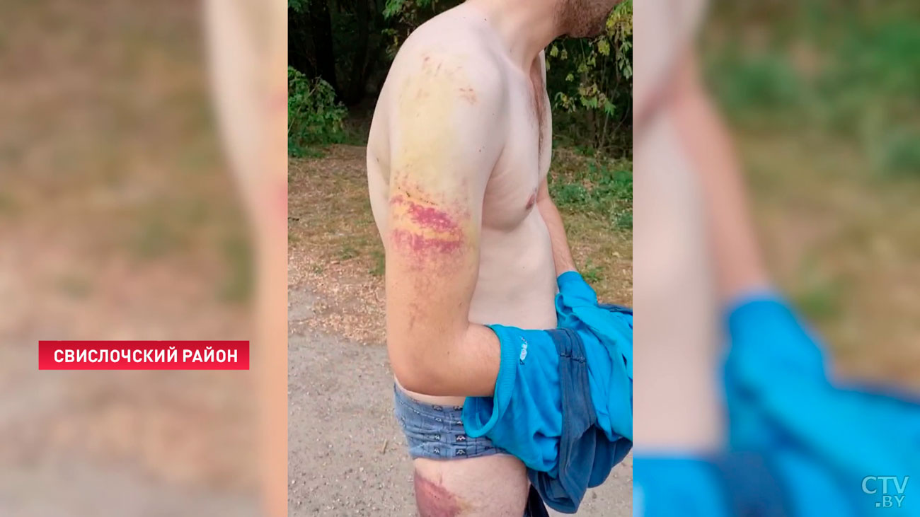Польские силовики избили и бросили на белорусской границе двух беженцев из Сирии-1