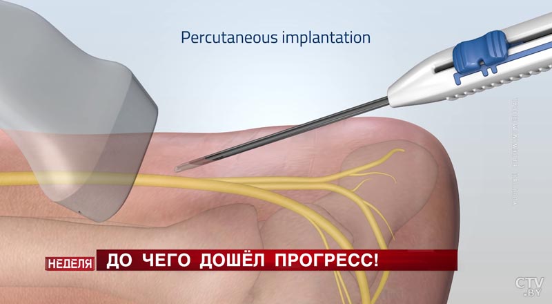 Как микрочип спасет от боли, и что слышит инновационный стетоскоп? Репортаж о достижениях цифровой экономики-10