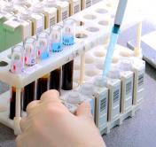 Цифры по коронавирусу на 5 октября. Готовы ли белорусские медики ко второй волне?