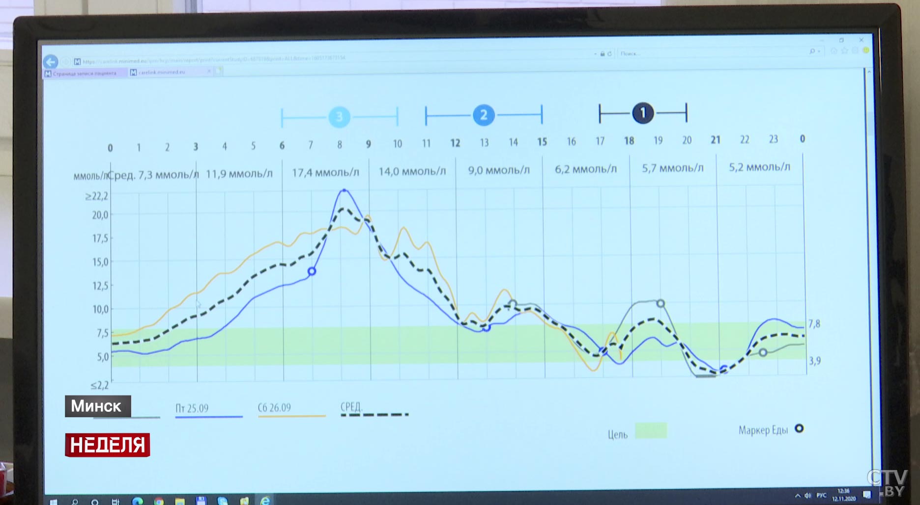 Контроль уровня сахара 288 раз в сутки, 600 тестов в час. Как работает современная система по изучению сахарного диабета?-4