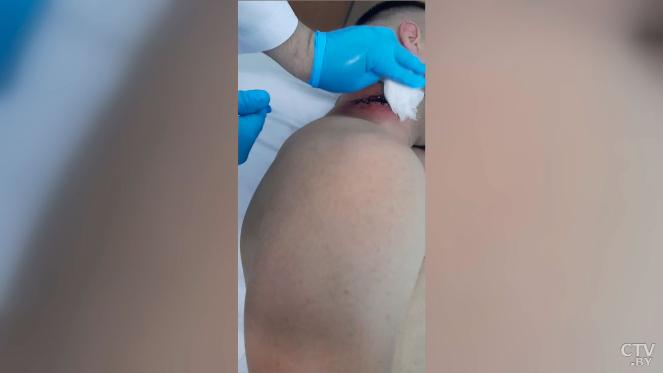 ​Стало известно имя гражданина Ирака, погибшего на границе с Литвой-7