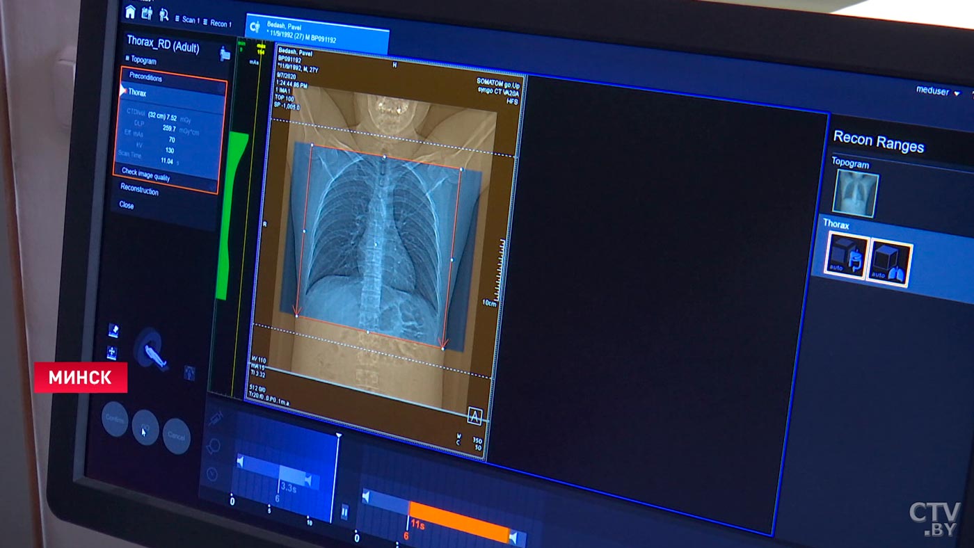 Шесть компьютерных томографов поступят в стационары Минска до конца марта-4