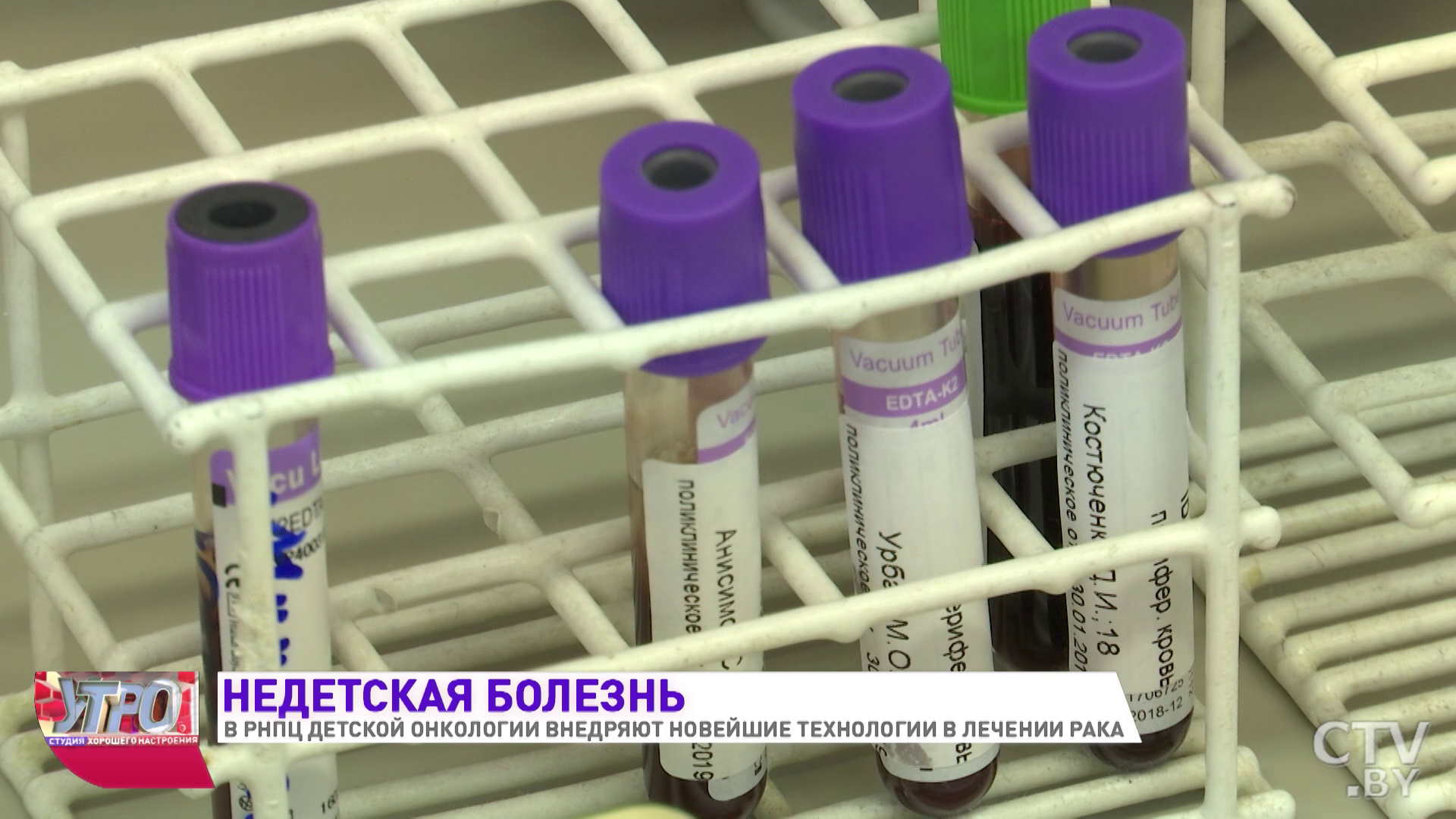 Естественные киллерные клетки. Какие ещё новейшие технологии лечения осваивают в РНПЦ детской онкологии-19