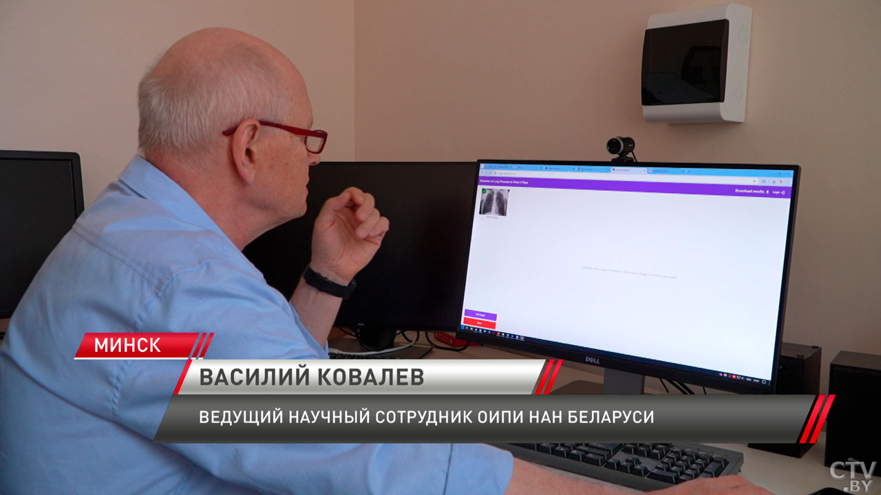Повысить качество оказания медицинских услуг! Как нейросеть поможет врачам в спасении жизни?-8 Повысить качество оказания медицинских услуг! Как нейросеть поможет врачам в спасении жизни?-8