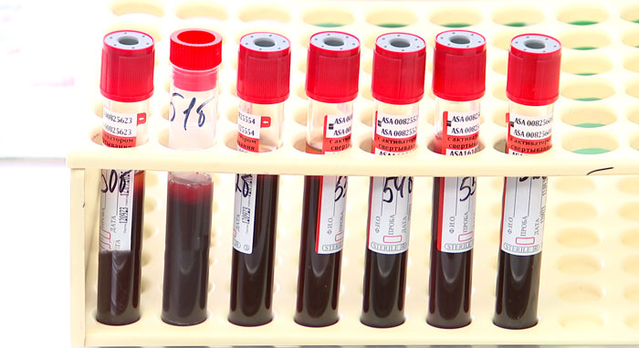 В Беларуси снижается количество новых случаев заражения ВИЧ-инфекцией