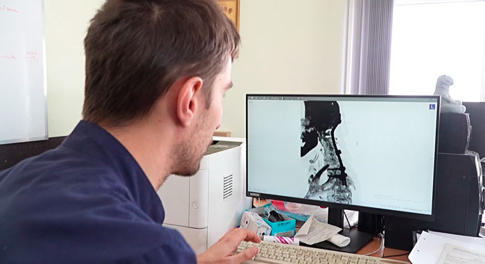 В Витебске провели уникальную операцию с использованием 3D-технологий