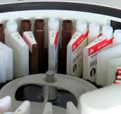 В Беларуси за сутки выявлен 1 701 новый случай заражения коронавирусом